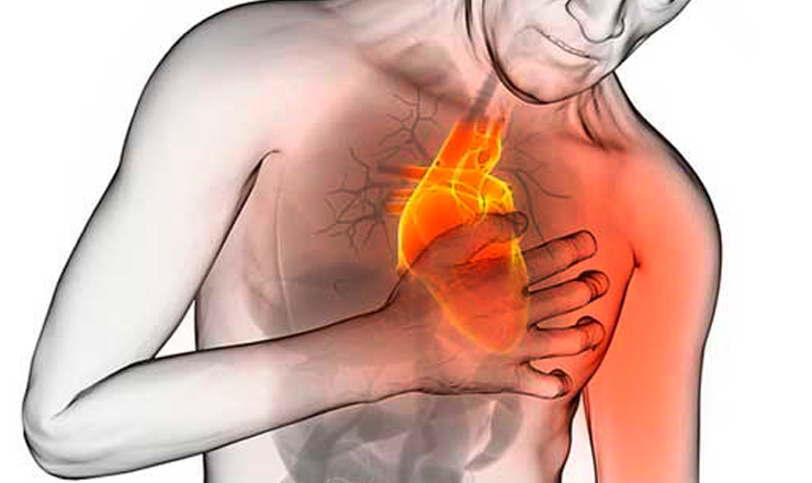Síndrome del "corazón roto": El impacto del estrés emocional que simula un infarto